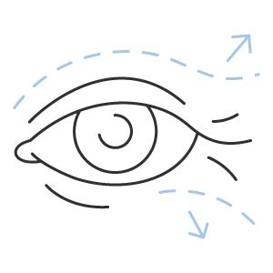 Blefaroplastia superior e inferior (cirurgia das pálpebras)