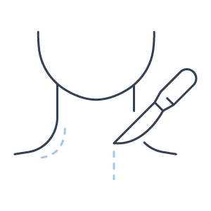 Cervicoplastia ou lifting do pescoço