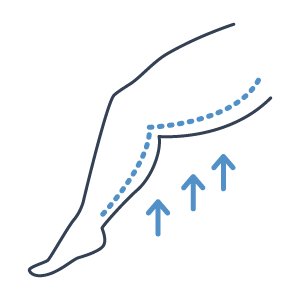 Cruroplastia (lifting das coxas)