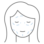 Ritidoplastia (lifting facial)