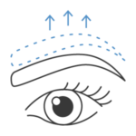 Lifting de sobrancelhas